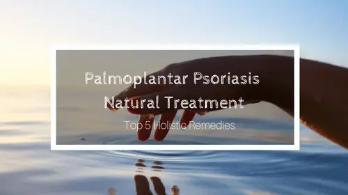 Palmoplantar Psoriasis Natural Treatment: Top 5 Holistic Remedies | Soap Lake Natural Spa and Resort