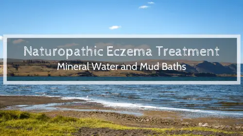 Naturopathic Eczema Treatment: Mineral Water and Mud Baths | Soap Lake Natural Spa and Resort