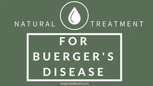 Natural Treatment For Buerger’s Disease | Soap Lake Natural Spa and Resort